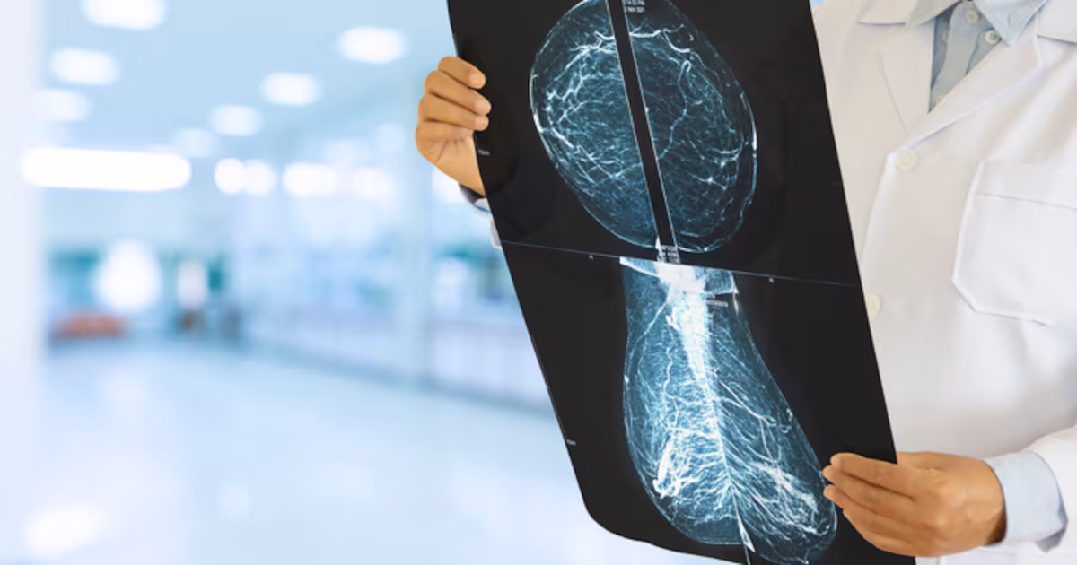 Canadian study suggests less breast cancer treatment may be just as effective, with fewer side