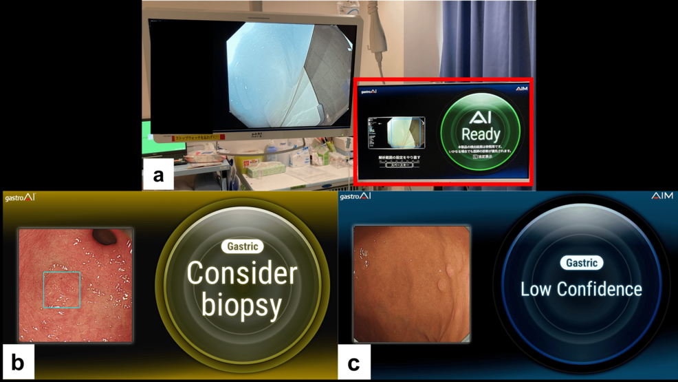 Usefulness of Artificial Intelligence for Transnasal Esophagogastroduodenoscopy in Clinical Practice