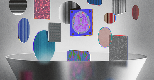 AI can’t solve the brain without data that fit together