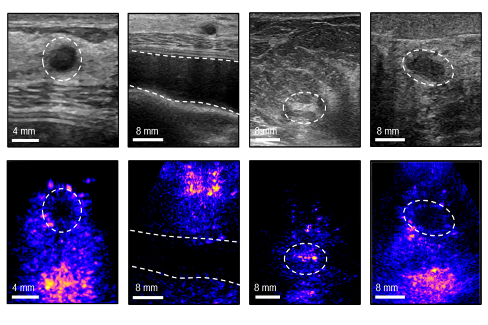 A portable ultrasound system could make reliable breast imaging more accessible