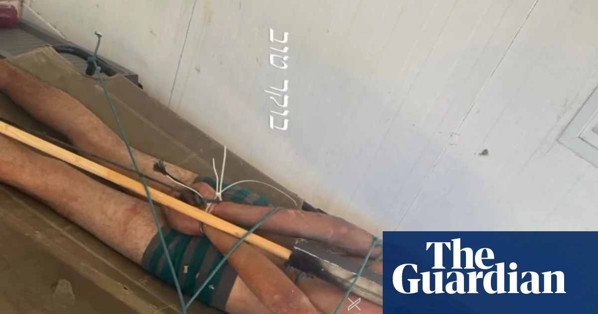 Photo of bound Palestinian detainee corroborates Israeli torture reports, say rights groups