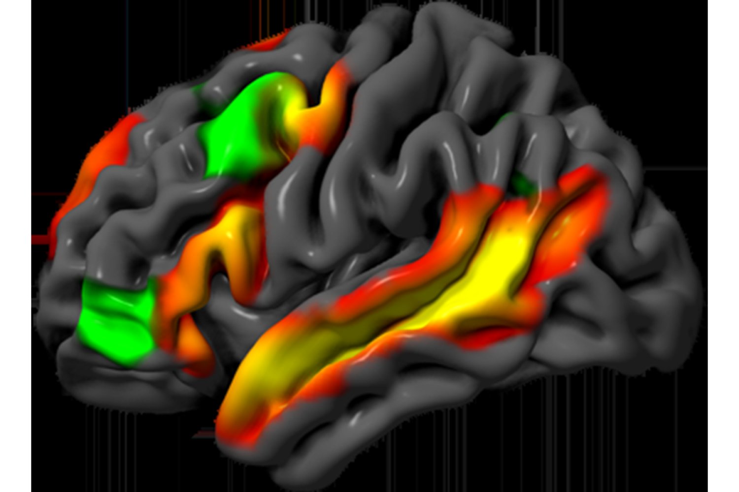 Separating logic and language