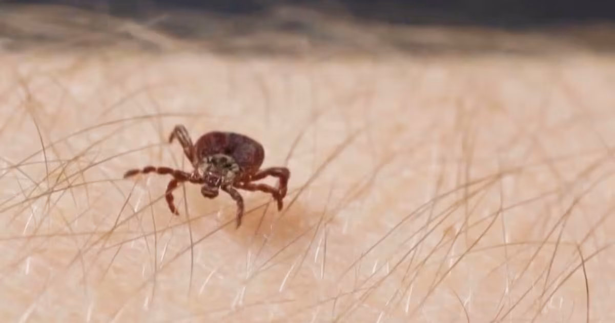 ‘My fingers were purple’: How a tick