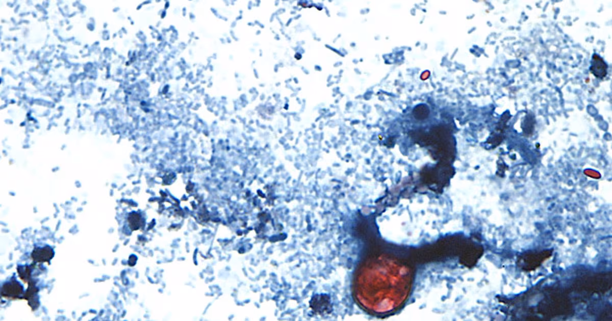 Canada is not banning produce imports amid U.S. cyclosporiasis outbreak, CFIA says