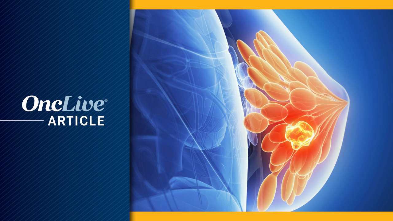 International Intel: A Glance at the Top Global Breast Cancer News From April