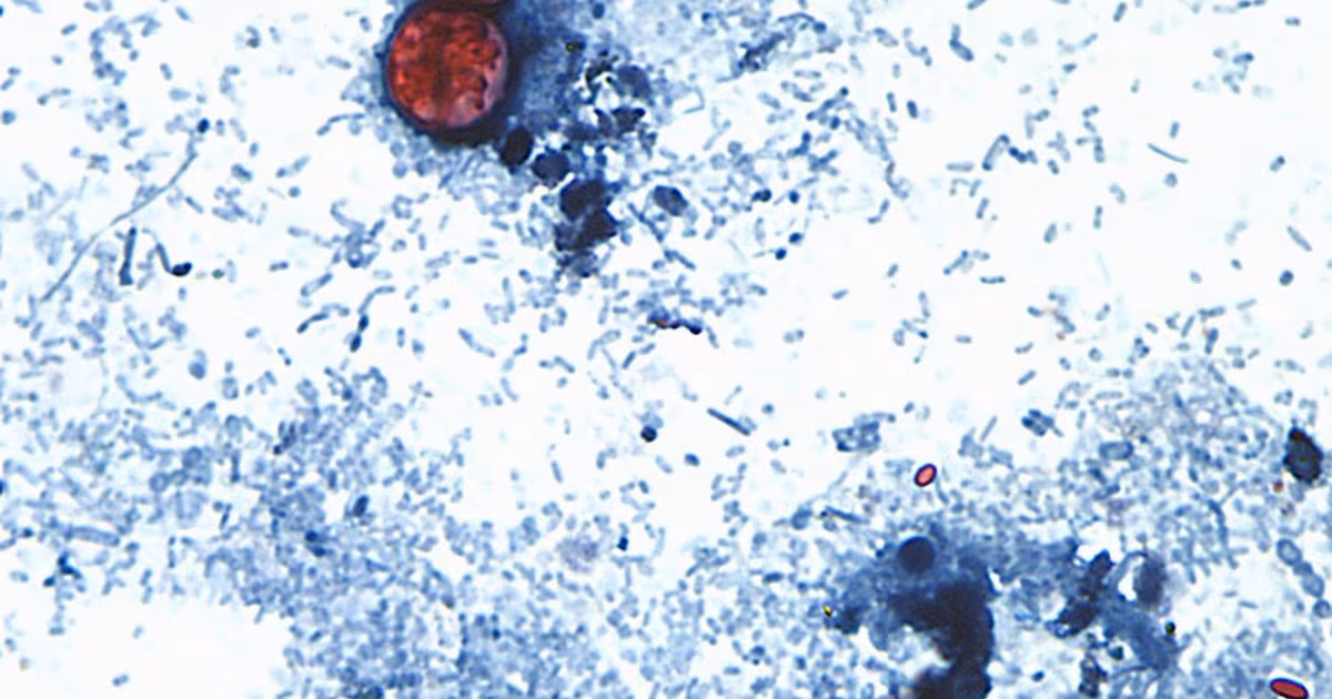 No cyclospora outbreaks reported or tainted lettuce sold in Canada, officials say