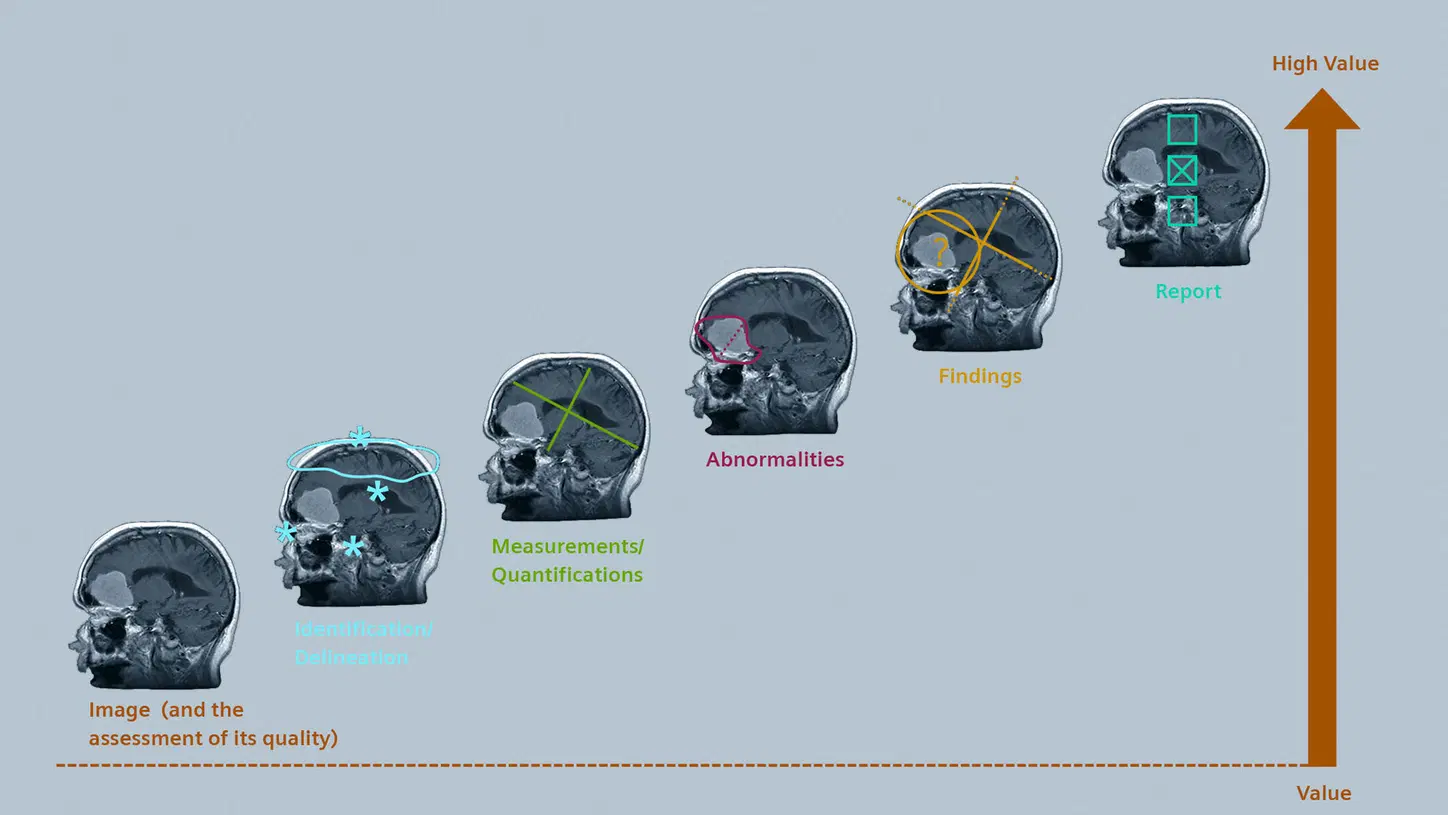 Artificial Intelligence for MRI