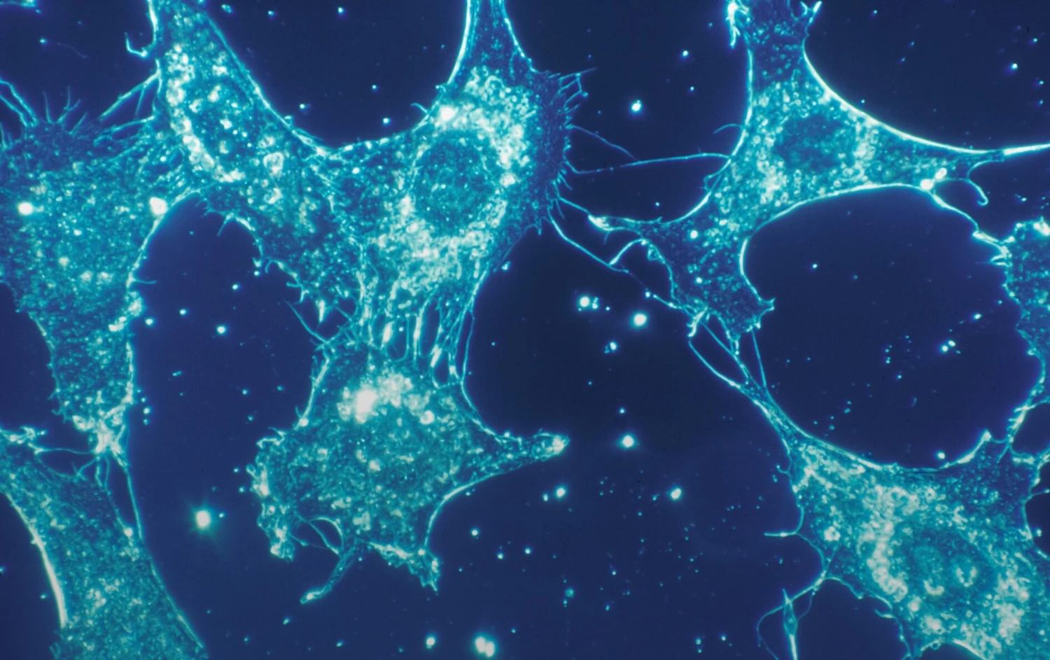 RNA Technology Improves Islet Transplantation Outcomes