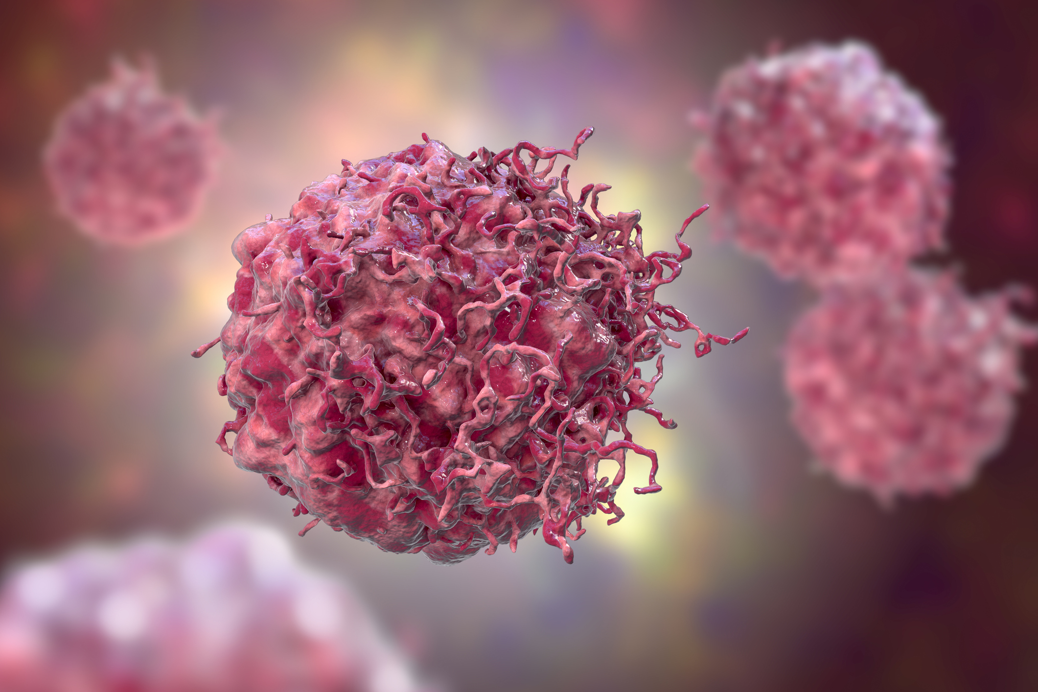 Novel Spatial Technology May Improve the Understanding of Cancer Biology