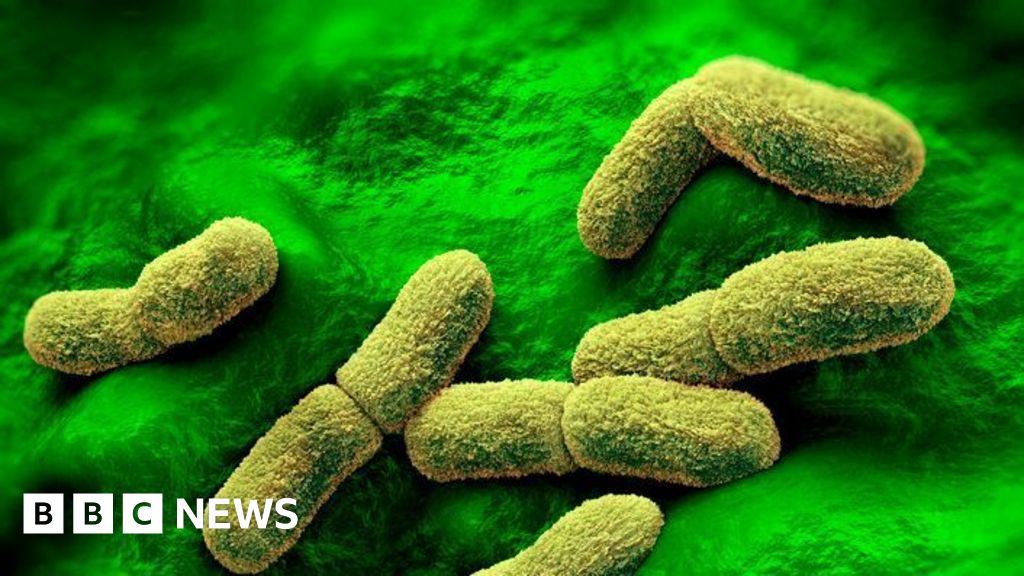 US 'watching closely' after plague researcher dies in Russia