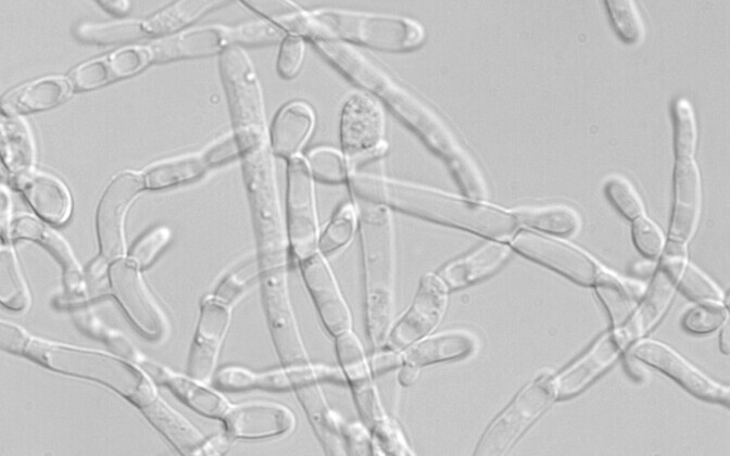 Artificial intelligence helping turn yeast into a better cell factory